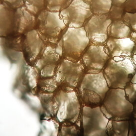 Celluledel sugherosezione trasversale Celluledel sugherosezione trasversale